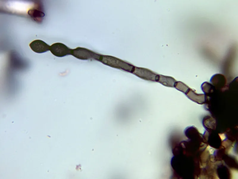 Alysidium resinae 10 - Apilado conidióforo